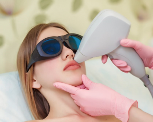 woman laser hair removal theropy on her upper lip